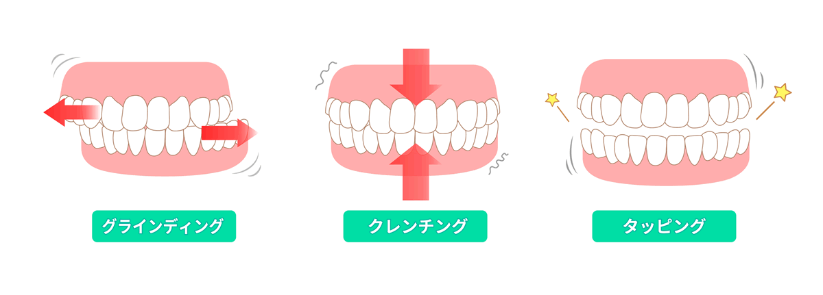 G剻@ُؓ̈^@wxƁw΂x